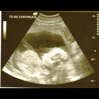 ultrasound2.jpg