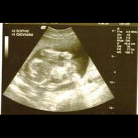 ultrasound1.jpg